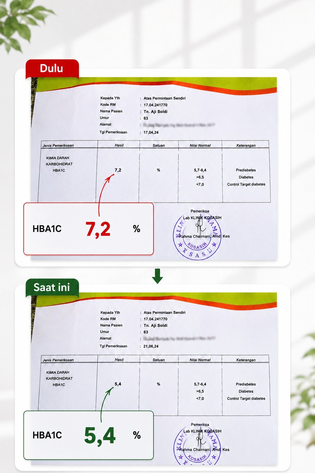 Hasil Lab HbA1c Pak Aji Sebelum dan Sesudah Konsumsi Diaberis